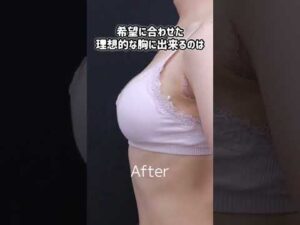 【豊胸】シリコンバッグで大胆なバストアップが可能 !?【湘南美容クリニック】【新宿本院院長 中村大輔】#整形 #豊胸 #シリコンバッグ #豊胸 #ダウンタイム #バストアップ #美容  #バストケア