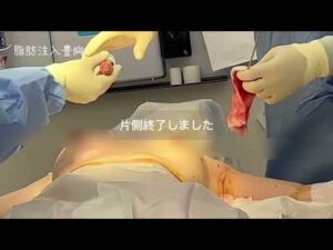 細身【脂肪注入豊胸】しっかりバストアップ