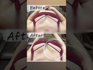 街で出会ったお姉さんに30分バストアップ施術をしてみた結果