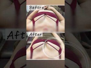 街で出会ったお姉さんを30分でバストアップ施術をしてみた結果…