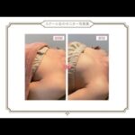 【ビューティワールドジャパン】連日大盛況🎉今注目のバストアップエステ✨理学療法士×看護師考案‼︎理論に基づいて開発された、オールハンドの最強バストエステ⚡️