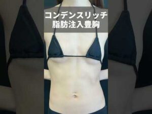 【豊胸】ハリのあるふっくらバストになりたい❗️そんなお客様には脂肪注入豊胸がおすすめ💖 #shorts