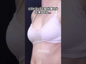 【部分痩せ×バストアップ】SBC幹細胞豊胸【湘南美容クリニック】【新宿本院院長 中村大輔】 #バストアップ #美容整形 #美容 #豊胸 #部分痩せ #バストアップしたい  #美容クリニック