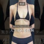 【神定着】人生変わる豊胸術‼️#バストアップ #shorts