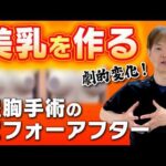 【脂肪豊胸】劇的変化！美乳を作る豊胸手術のビフォーアフター