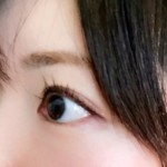 二重まぶた埋没法とは？