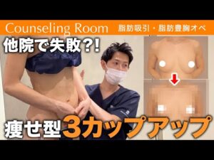 他院では大きくならなかった細身の女性が脂肪豊胸でGカップに！確実にバストアップする豊胸術とは？【Dr.吉江 脂肪吸引カウンセリングルーム】