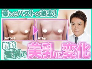 【症例紹介】痩せ型や垂れたバストの悩みを克服！脂肪豊胸のプロが徹底解説します【脂肪吸引 バストアップ】