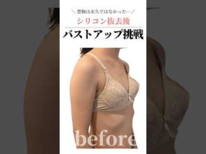 豊胸したけど【永久的】なんて嘘！今度こそバストアップしたい！！ #cocia #バストアップサロン #shorts #美バスト #表参道 #バストアップ