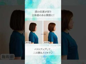 歪みの改善・バストアップ整体　 #お腹痩せ #バストアップ