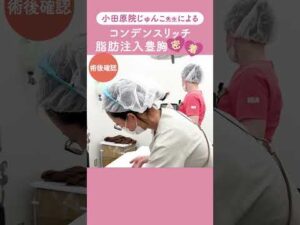 【密着★コンデンスリッチ豊胸】部分痩せとバストアップ両方叶える!!