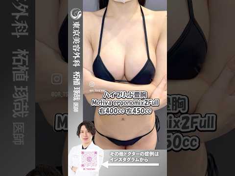 ハイブリッド豊胸で左右差なくボリュームのあるバストに！ #shorts #ドクターa #美容 #東京美容外科 #整形 #麻生泰 #美容整形  #シリコンバッグ #豊胸 #赤坂