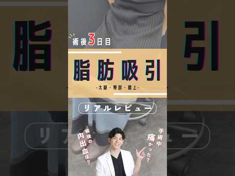 脂肪吸引リアルレビュー#湘南美容クリニック #美容 #美容整形 #脂肪吸引 #太もも痩せ