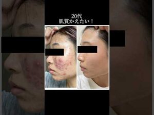 サロン紹介🌿#金町 #エステ #ニキビケア #小顔 #バストケア #痩身 #ダイエット#エステサロン #エステ #葛飾区