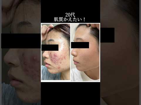 サロン紹介🌿#金町 #エステ #ニキビケア #小顔 #バストケア #痩身 #ダイエット#エステサロン #エステ #葛飾区