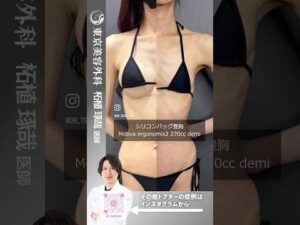 痩せ型タイプの人はデュアルプレーン法で綺麗なラインでバストアップ #shorts #ドクターa #美容 #東京美容外科 #整形 #麻生泰 #美容整形 #赤坂 #豊胸 #バストアップ #コンプレックス