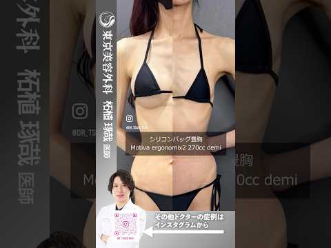 痩せ型タイプの人はデュアルプレーン法で綺麗なラインでバストアップ #shorts #ドクターa #美容 #東京美容外科 #整形 #麻生泰 #美容整形 #赤坂 #豊胸 #バストアップ #コンプレックス