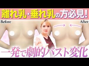 【バストアップ】離れ乳・垂れ乳バストになる原因と特徴とは？改善方法までプロが徹底解説します【シリコン豊胸 脂肪豊胸】