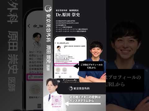 服の上から存在感のあるおっぱい！３カップアップ！ #shorts #ドクターa #美容 #東京美容外科 #整形 #麻生泰 #美容整形 #池袋 #豊胸 #バストアップ #コンプレックス