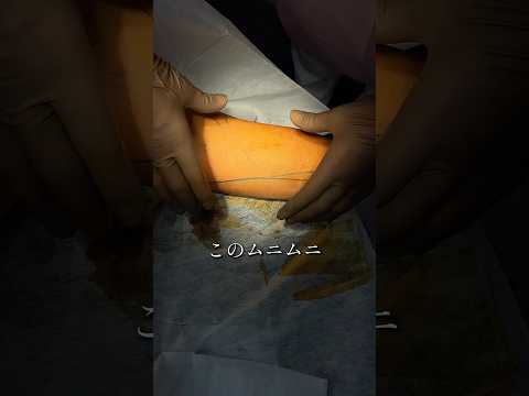 【衝撃】このムニムニ感… #湘南美容クリニック #美容 #美容整形 #脂肪吸引 #二の腕痩せ