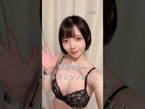 【脂肪豊胸】1か月のダウンタイム#湘南美容クリニック #美容 #美容整形
