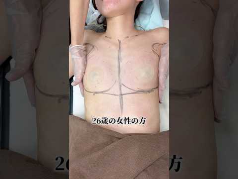 #湘南美容クリニック名古屋院 #バストアップ #シリコンバッグ豊胸 #豊胸 #垢抜け