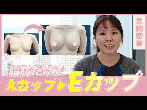 【2次豊胸】脂肪だけで４カップアップ？！現役美容ナースの豊胸に完全密着★