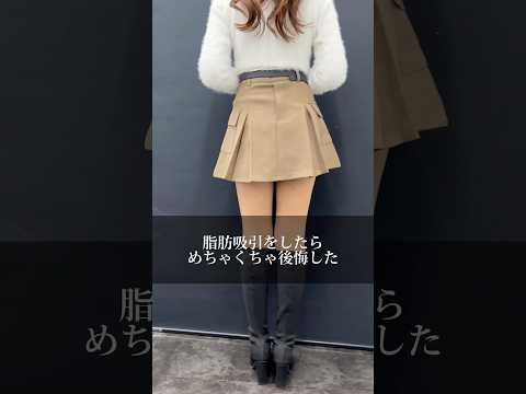 脂肪吸引したら【めちゃくちゃ後悔した】　#美容整形 #美容 #脂肪吸引 #太もも痩せ