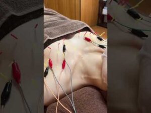 バストケア、実は「塗る」より「緩める」が先です‼️筋肉が柔軟になれば、バストは自然とふっくら高い位置へ#バストケア#デコルテ #産後ケア#巻き肩#鍼