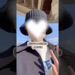 豊胸ダウンタイム３日目！#バストアップ #脂肪注入豊胸 #湘南美容クリニック名古屋院