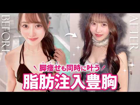 【骨格ウェーブ必見】脚の脂肪でバストアップ！脂肪注入豊胸で「痩せる」と「育てる」を同時に叶える方法