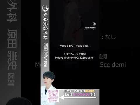 卒乳後のたるみをハリのあるおっぱいに！ #shorts  #ドクターa #美容 #東京美容外科 #整形 #美容整形 #池袋 #豊胸 #バストアップ #コンプレックス#美乳 #ビフォーアフター