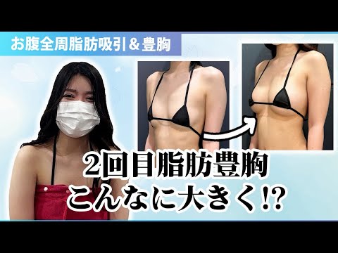 前回から大幅バストアップ！2回目は定着が全然違う？！