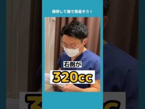 【脂肪豊胸】左右差調整しつつ600cc注入！