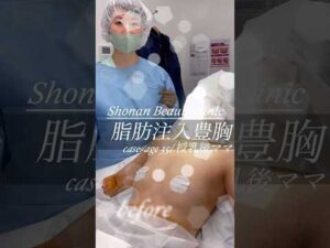 脂肪注入豊胸　#美容医療 #脂肪豊胸 #バストアップ