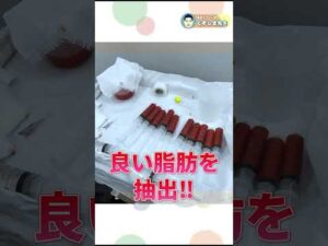 【豊胸 脂肪注入 バストアップ】痩せ型のお客様が2回の豊胸手術に挑む！ #shorts