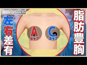左右でA-Cカップ差がある…これを治してさらに大きくもしたい！脂肪豊胸の難オーダーは可能か！？｜vol.608【ボディデザインTV】