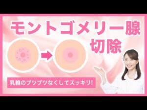 乳頭周りのブツブツ「モントゴメリー線」について