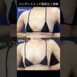 【豊胸】バレたくない人にも❗️自然にバストアップ💖 #shorts