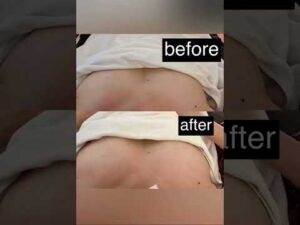 口コミ満点のサロンでバストアップ体験してみませんか？一回だけで効果抜群です👍👍 #ウエスト痩せ #ニキビケア #ハイドラ #ハイフ #小顔 #小顔になる方法 #痩身エステ #美肌 #バストアップ